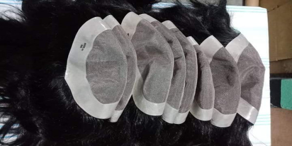 Durgapur Hair Replacement